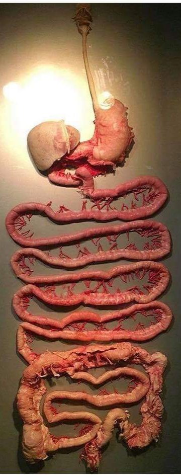 CartmailSteve's tweet photo. Its the 2nd day of Crohns &amp; Colitis Awareness week.
I thought I'd share this interesting picture of the digestive tract.
Crohns Disease can affect any part of this tract.
Ulcerative Colitis affects the large colon or (Bowel)
NOT ALL DISABILITIES ARE VISIBLE
Remember that💜 https://t.co/CLDrmDFlQ7