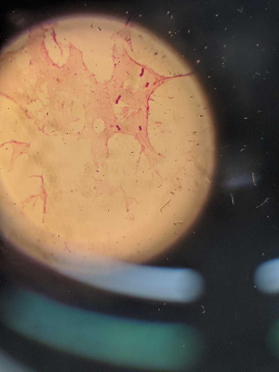 Spotted! Another GNCB in a little baby blood culture. This one and the one previously, both Moraxella! #micromonday #underthemicroscope #microbiology #gramstain