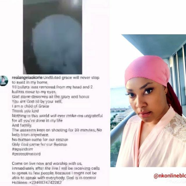 K_mflex's tweet photo. #AngelaOkorie describes recent attack on her as an assassination, says 10 bullets were removed from her head
.
.
.
.
.
.
.
.
.
.
#nkonlineblog #angelaokorie #tacha #BBNaija #mercyeke #nollywoodactress #naijacelebrity #naijablogger #londonbloggers #imost… https://t.co/DBIhqNM1Ki https://t.co/lAlEiWIaAM