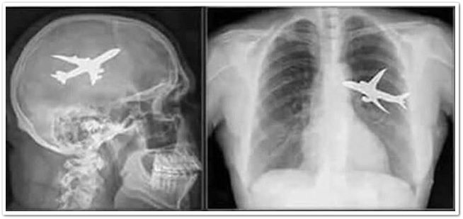 around_365's tweet photo. I'm Sick??? Is it serious??? 😱🤪 #Travel #travelphotography #travelers #TravelBlog #traveler #Tourism #tourist #vlog #vlogger #photography #photo #FunniestTweets #Airplane https://t.co/88CuPTzayY