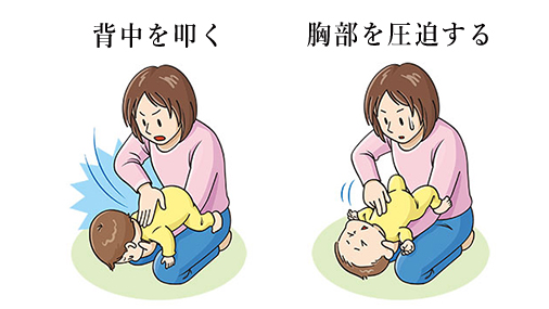 【印刷可能】 赤ちゃん 喉詰まる 232809赤ちゃん 喉詰まる 症状 Imagejoshxcl