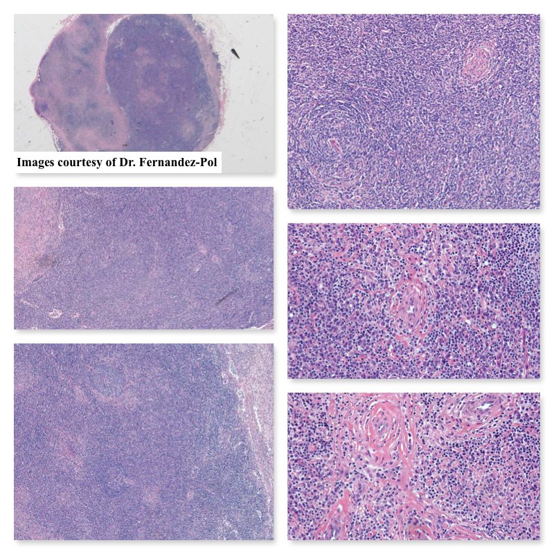 South Bay Pathology tweet media