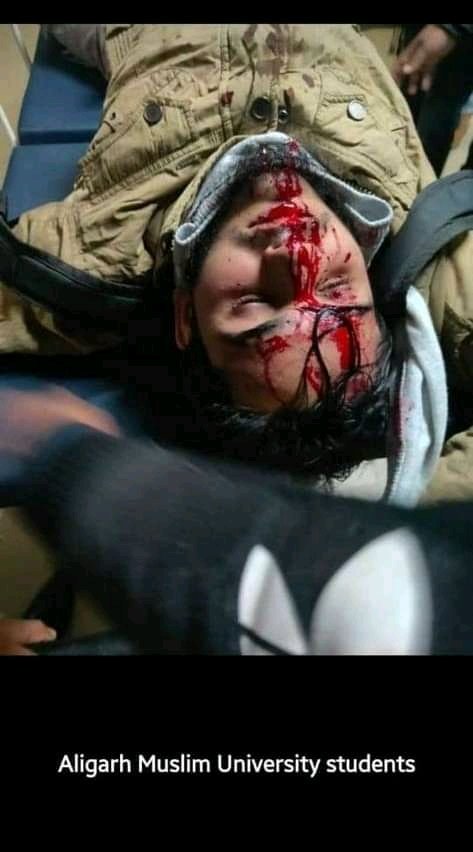 muzahi_d's tweet photo. OH Allah save Muslim Ummah #SaveIndianMoslim #SaveMoslimUmmah #RejectCAB #RejectNRC #SanctionModi https://t.co/yP4Gk9sF42