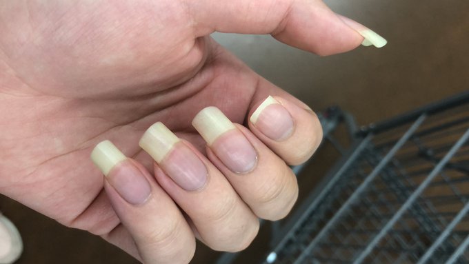 When some stupid fucking bitch hits your hand perfectly with a shopping cart not paying the fuck attention<a href="/tag/newprofilepic"class="tags"><span>#newprofilepic</span></a>