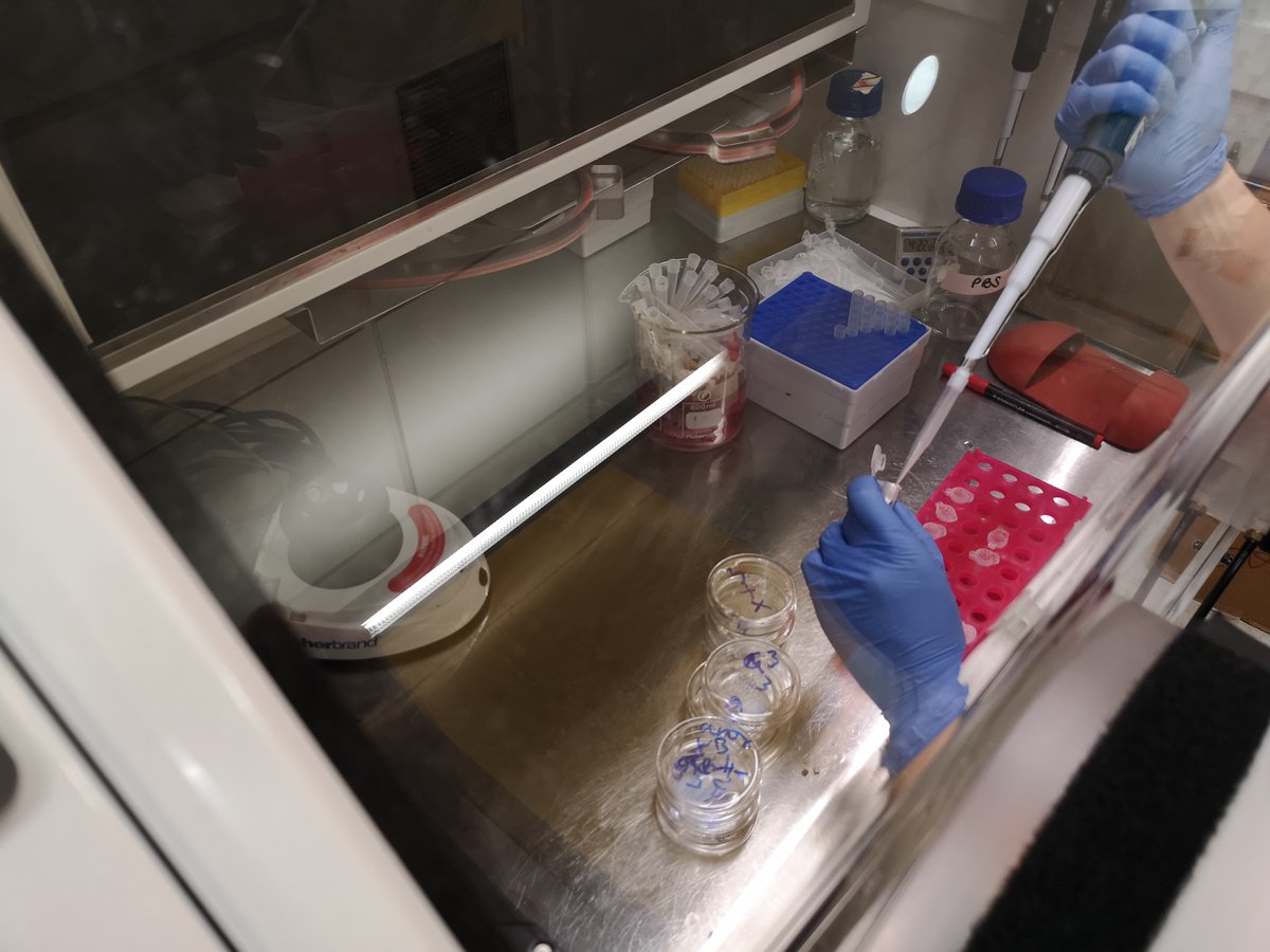 OxfordOncology's tweet photo. How do oxygen levels affect #Cancer cells?
Understanding this gives us a clue as to how we might better approach treating cancer in the future...
➡️🔬https://t.co/yzlSsmfWMW
#AdventCalendar #STEMadvent #Hypoxia https://t.co/Z95DNQo12l