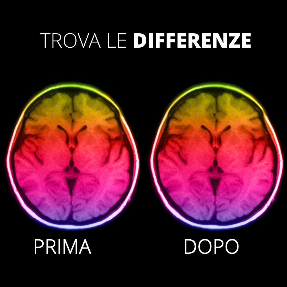 GFerrajolo's tweet photo. TROVA LE DIFFERENZE 👀
Cervello femminile prima e dopo un figlio.
La soluzione in fondo 👇
👇
👇
👇
Non avete trovato nulla?
Esatto!!!
.
Segui @womantimeswebtv 📺
.
#womantimeswebtv #woman #donna #mamma #donnaemamma #lavoro #GirlPower #DonneELavoro https://t.co/WSUEhuEjvR