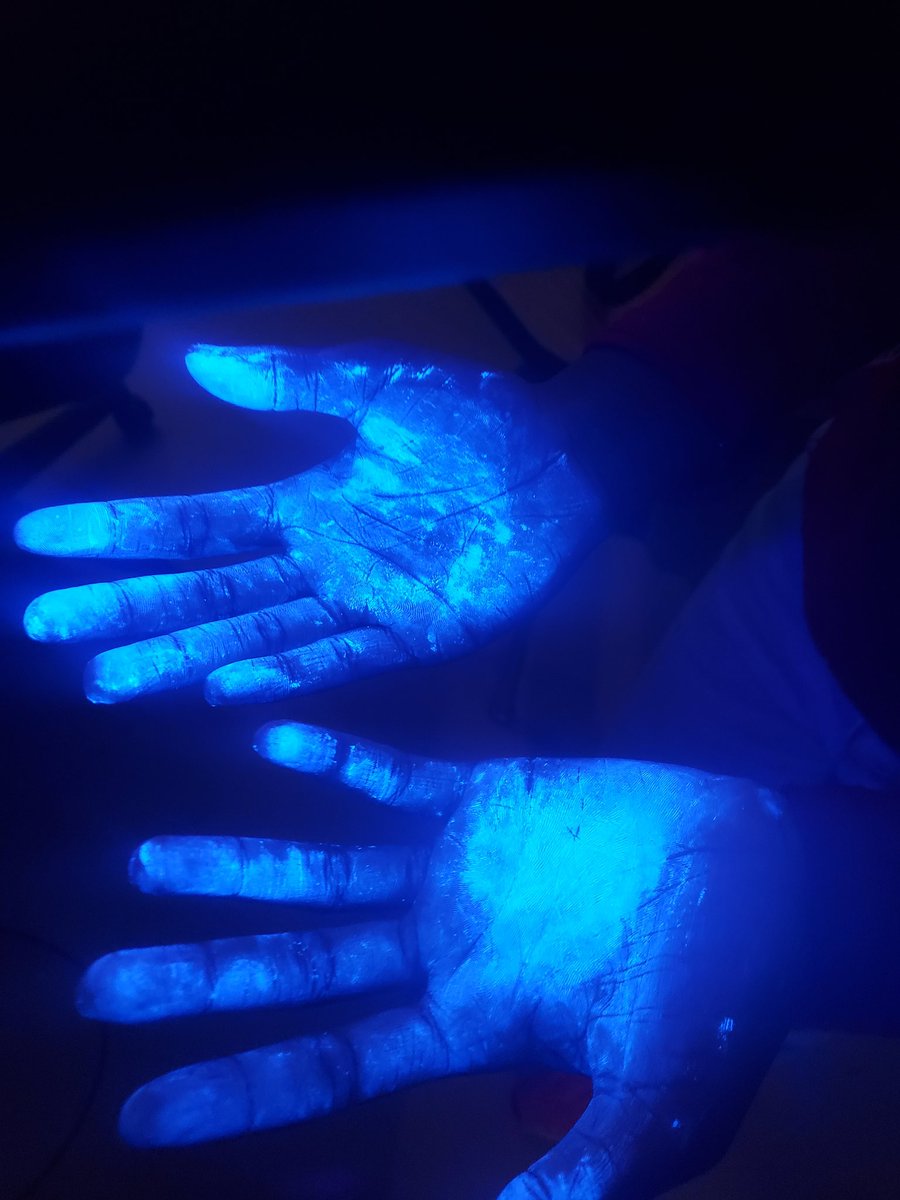 BarronScience's tweet image. Spreading pathogens! Ok, investigating it with Glo-germ powder...but it's way more exciting and less risky! @JeffersonJH68 @Woodridge68