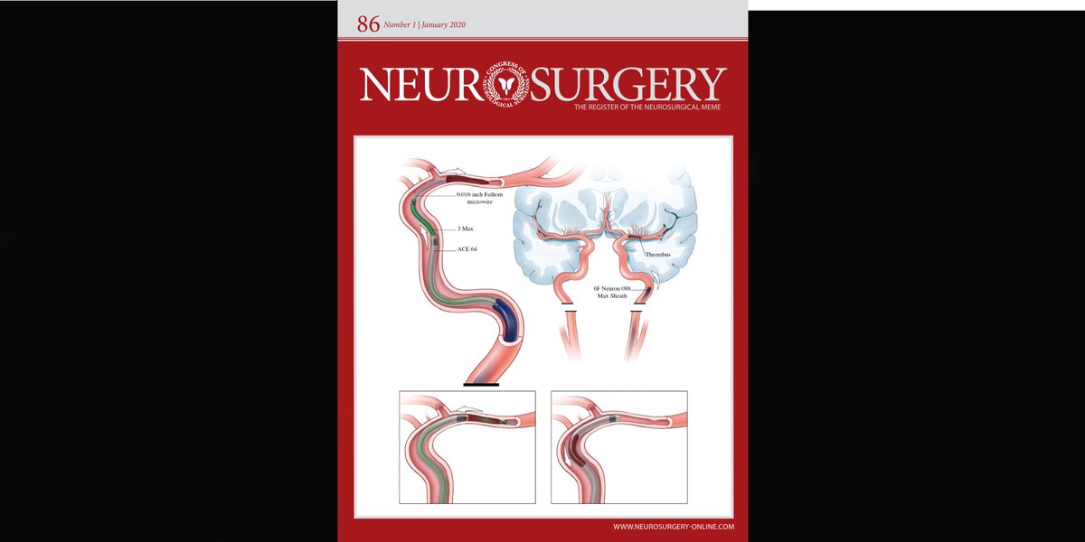 NeurosurgeryCNS's tweet photo. #NEUNewIssue The Brand-New January Issue of
@NeurosurgeryCNS is here! Featuring Concussion Guidelines, the latest in the Review Series on Biostatistics and Methodology for the Neurosurgeon, a Special Article and much more! #ConcussionGuidelines https://t.co/kyqgGLYk26 https://t.co/95tygIDXuh