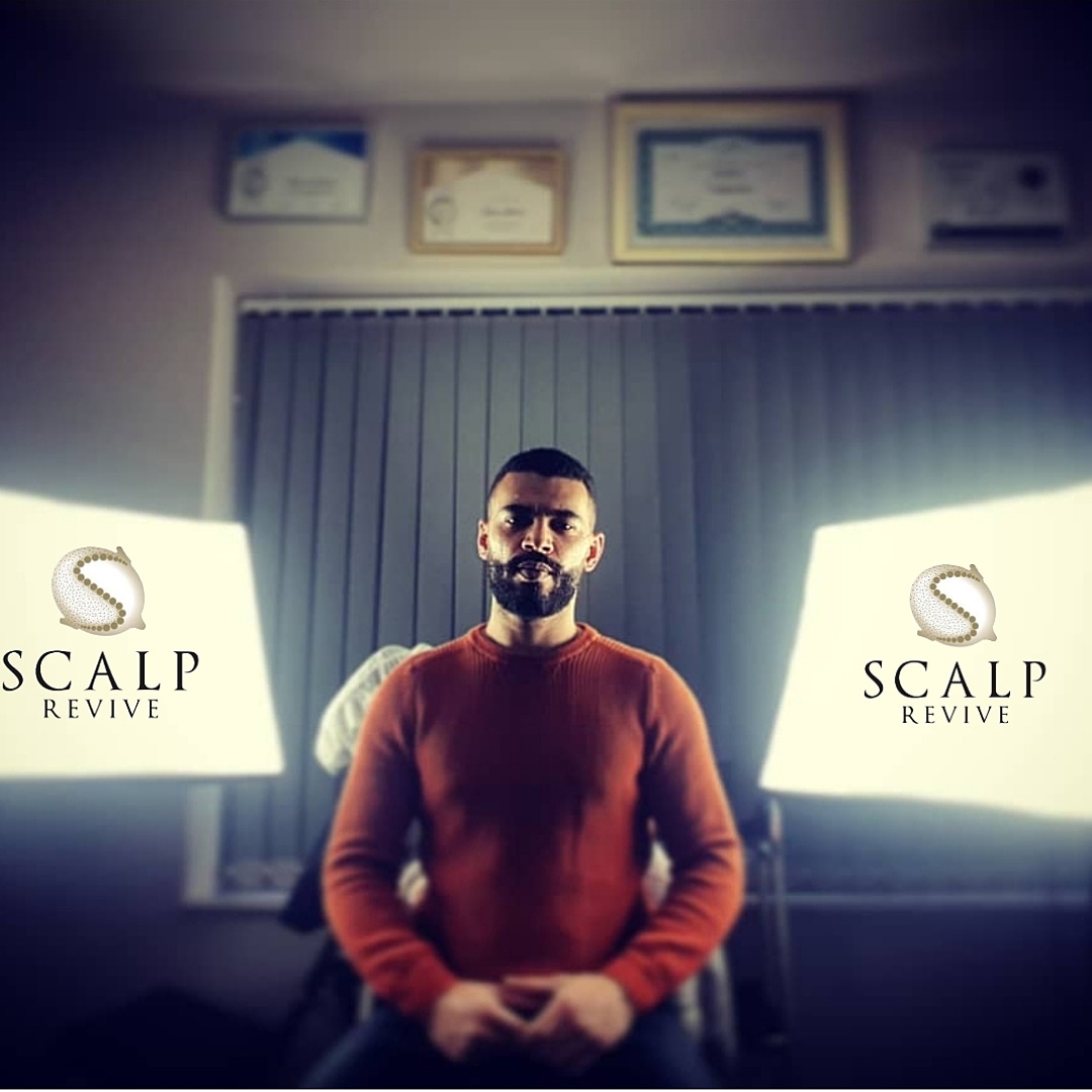 ScalpRevive's tweet photo. Scalp Micropigmentation Specialist Shane Anderson. https://t.co/7rMfOgbPKC