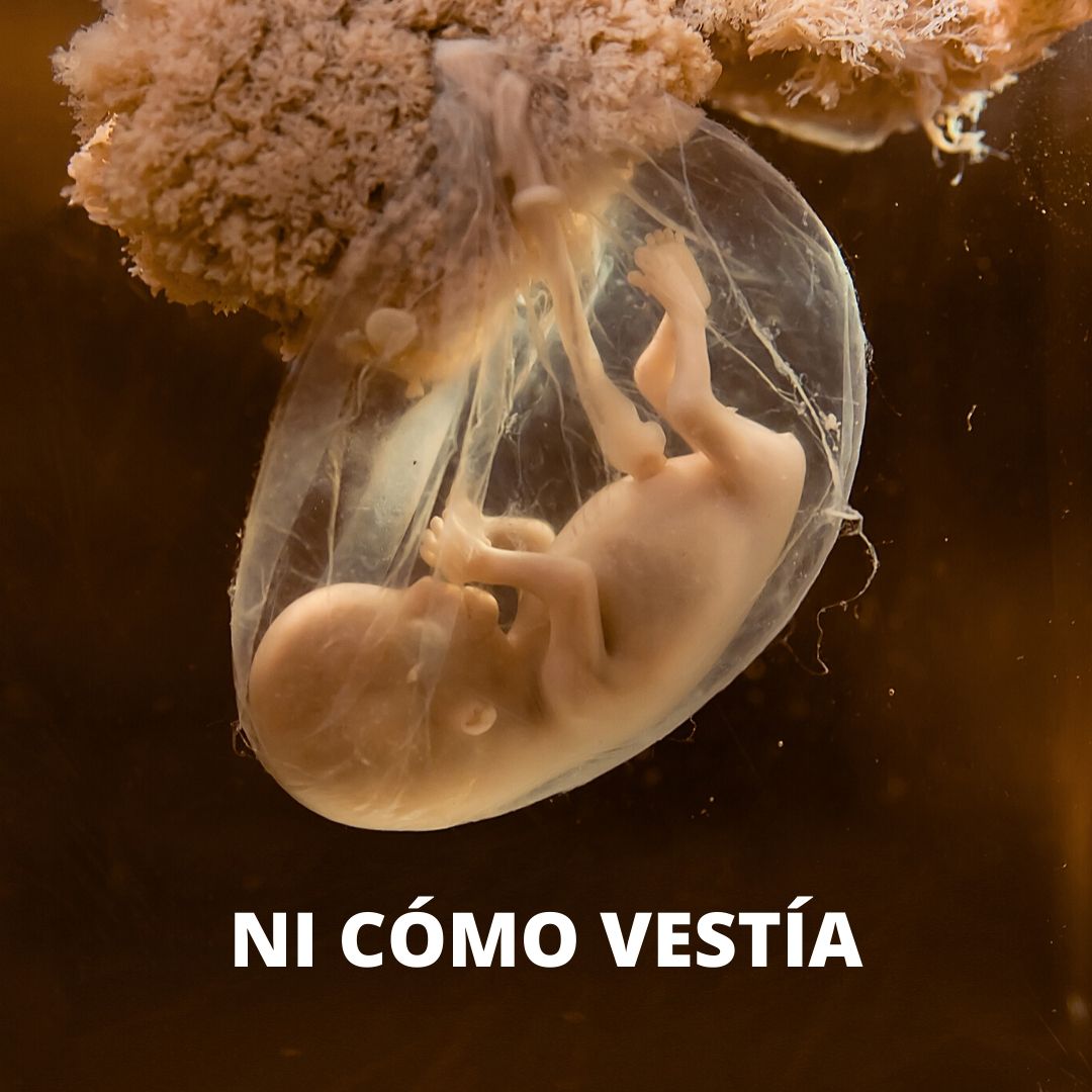MarcosVeraPrez1's tweet photo. Y la culpa no era mia... https://t.co/G9lVFWqwRz