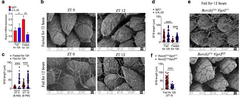 mmw_lmw's tweet photo. How a #Gut_Neuronal_Signal triggered by food intake is integrated with #Intestinal_AntiMicrobial and #MetabolicResponses controlled by #ILC3 | Dan Littman @SkirballNYUSoM @biorxivpreprint https://t.co/iN8T9Vitrk https://t.co/9JfYzintH8