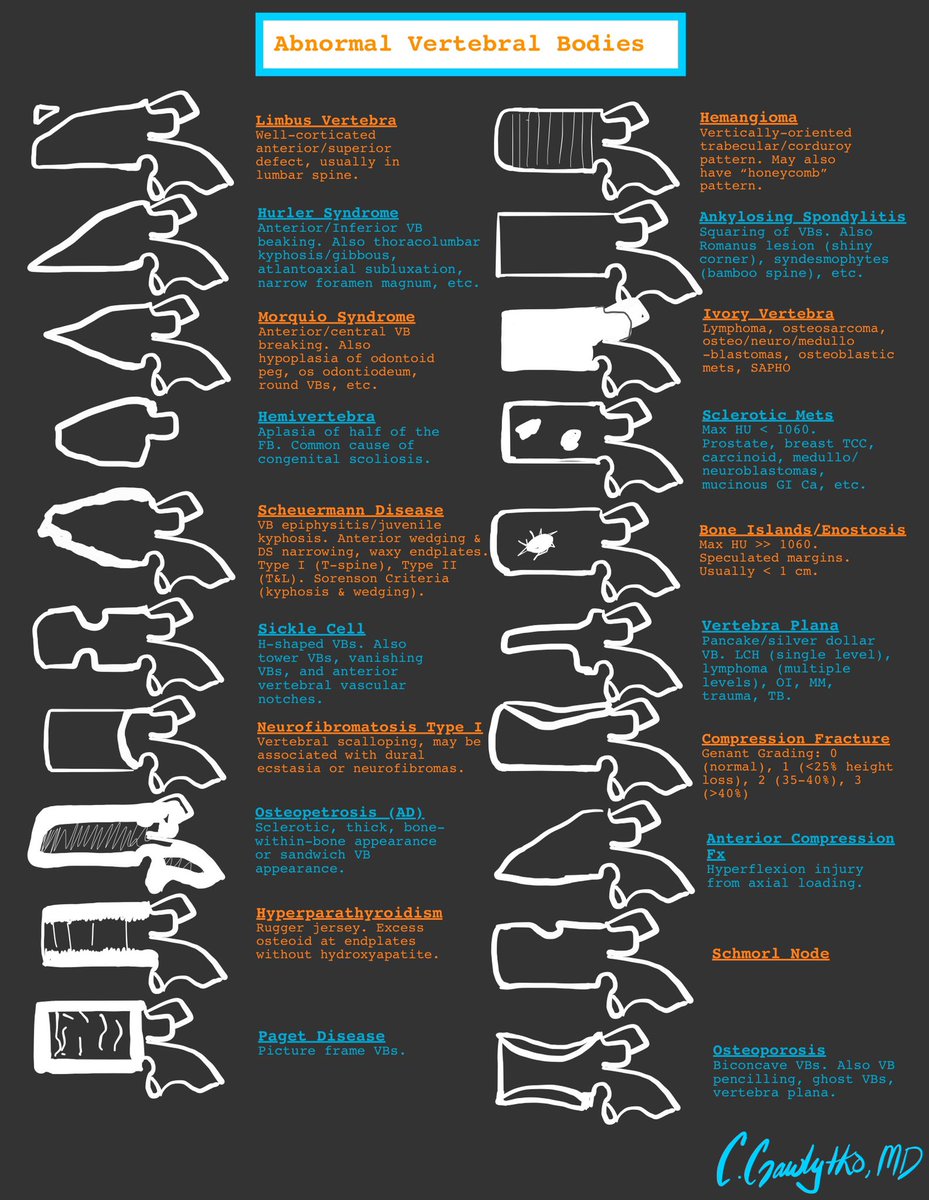 drcyncity's tweet image. A sheet of common (and uncommon) vertebral body findings, because a completely “normal” spine seems quite hard to come by!