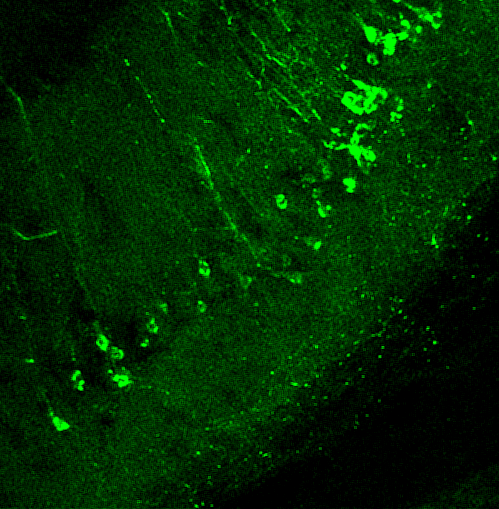 SinaiBrain's tweet photo. #ArtoftheBrain image #7 is from @MSHSNeurology’s Syed Faraz Kazim of an abnormally hyperphosphorylated tau in the hippocampal CA1 sub-region of 15-16month old 3xTg-AD mouse identified using AT8 (pSer202/pThr205) antibody. #PereiraLab @IcahnMountSinai VOTE NOW! Most♥️s wins! https://t.co/e11zSFEmer