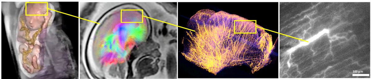 Tiny Human Brains tweet media