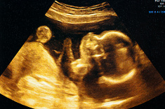 ParentInfantFdn's tweet photo. Babies’ brains are sensitive to both the physical environment of the mothers’ womb &amp; the relational environment beyond it. Parent-infant relationships are vitally important for building the brain architecture upon which other forms of development will rest. #earlyrelationships #9 https://t.co/gGLRqWWOj9