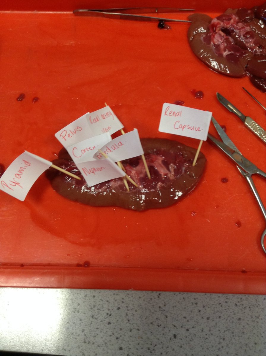 MaestegScience's tweet photo. If you have a weak stomach it's time to close your eyes! Luckily our A-level class aren't squeamish when we dissected and identified the structures of the kidney... #motivatedtostrive #AlevelBiology #kidneydissection https://t.co/elOmPcBgcB