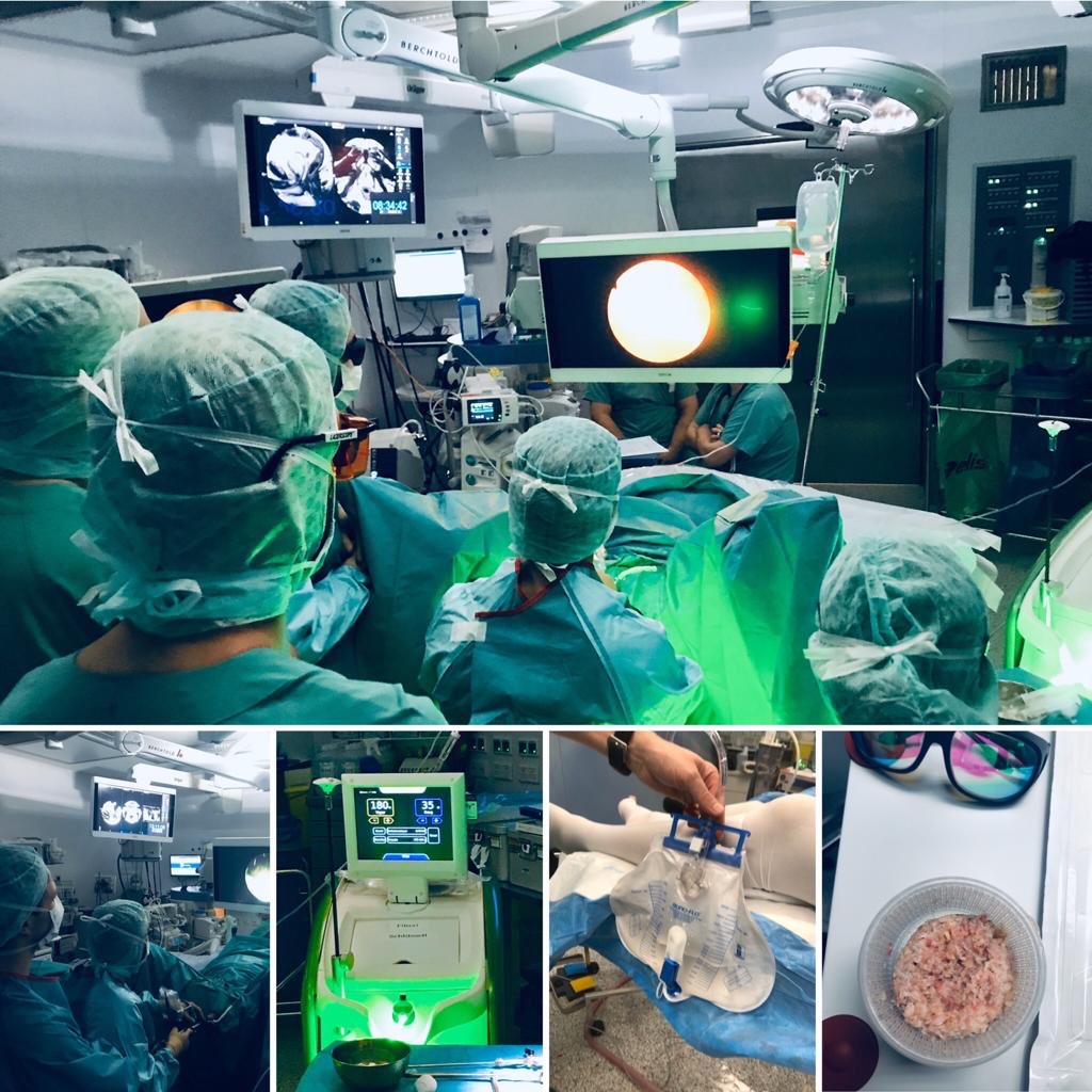 CashHannes's tweet photo. Today @RUBUrology in Herne with @marko_brock to proctor #GreenLep and anatomic #PVP with #greenlight.  Two cases done, two to go. #AEEP #treatbph @enrique_rijo @VMisrai @fgomsan @bsc_urology @Dr_KevinZorn https://t.co/Vial7js23R