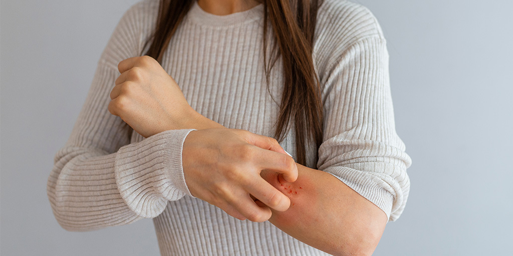 thedermgroup's tweet photo. NEW CLINICAL TRIAL: PSORIASIS

Living with painful psoriasis? Creams and topical steroids often used to treat psoriasis can come with a number of limitations. The Derm Group is working to change that.

Looking for relief? Learn more at: https://t.co/aFO9sKVFZ5 https://t.co/KC2M6xFSIu