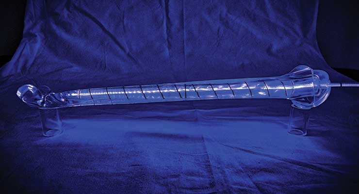 SamISureAm's tweet photo. My @ODTmagazine article examines innovative technologies for trauma repair from @NexxtSpine @IlluminOss and @BioventusGlobal --> https://t.co/EfjzsFRoeP https://t.co/ZnspANWAzi