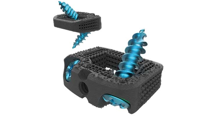 SamISureAm's tweet photo. My @ODTmagazine article examines innovative technologies for trauma repair from @NexxtSpine @IlluminOss and @BioventusGlobal --> https://t.co/EfjzsFRoeP https://t.co/ZnspANWAzi