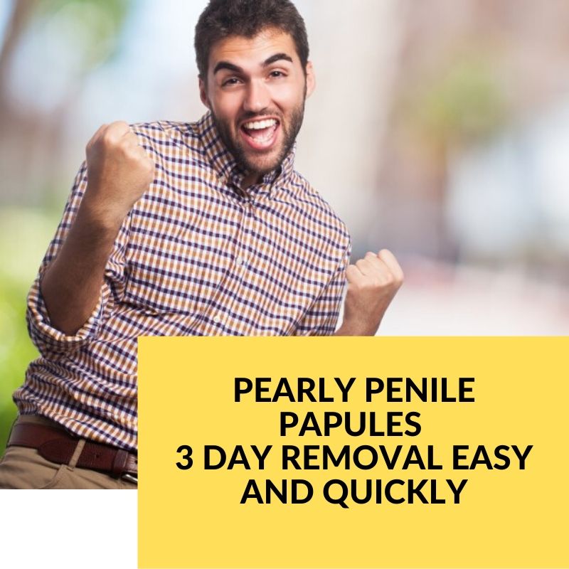 And removal quickly papules easy pearly Pearly Penile