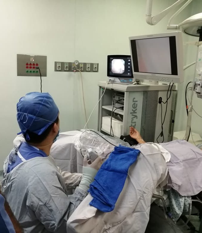 drvicenterivera's tweet image. Primer caso. Listo cáliz inferior derecho 12x12mm 890UH. Realizamos #RIRS con #Pusen. #Xrayfree