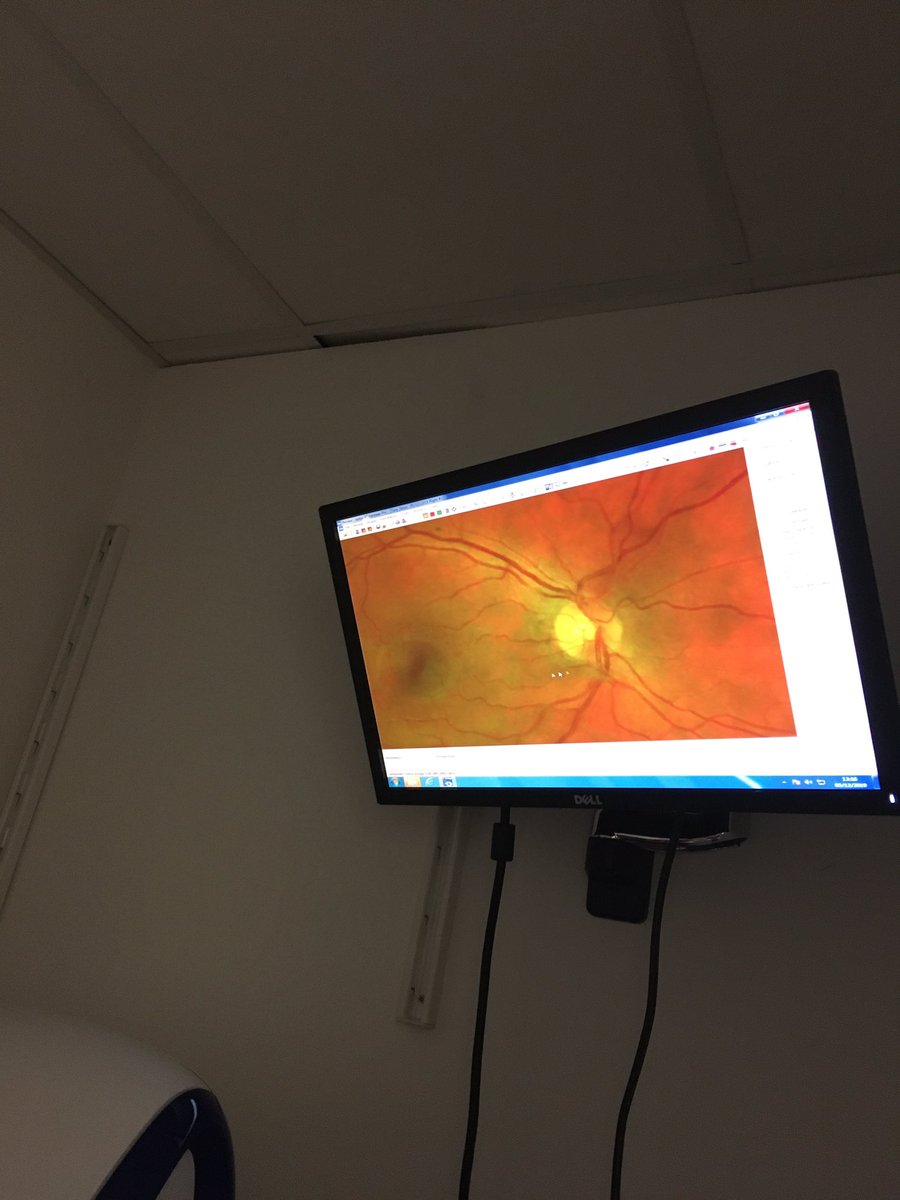 PentrerGraig's tweet photo. Dosbarth Venus learned more about the eye today. Diolch Mr Stout for showing us all the equipment you use to check eyes. #pgpscience #pgpcommunity #pgpvenus https://t.co/71lQOpXYzW
