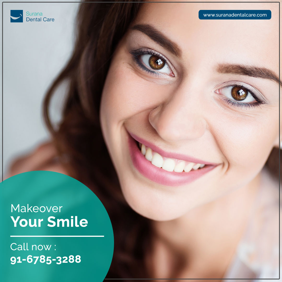 CareSurana's tweet photo. #Singletooth implant is a go-to solution to replace lost or missing teeth, owing to the long-term benefits it offers.
Book your appointment now @ https://t.co/RqZq9Fli8i

#dentalimplant #implant #odontologia #orthodontics #suranadentalcare https://t.co/N91DGDLprI