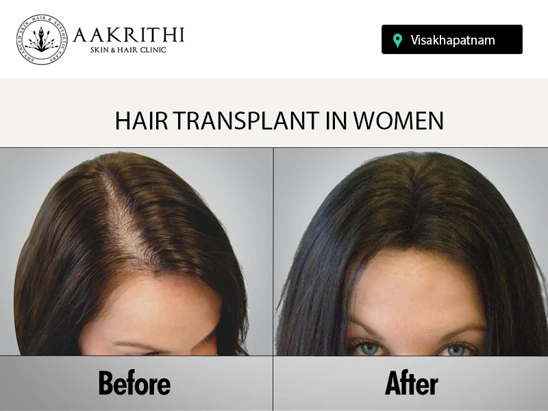 Aakrithi Skin and Hair Clinic  Vizag aakrithiclinic  Twitter