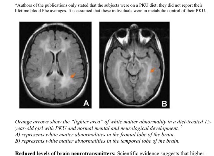 People with #pku can’t eat food without getting brain damage. The NHS offers the treatment of not eating food.
Medicine is available everywhere else for this condition.
#kuvan11yearswaiting #pegvaliaseHowLongforThisOne?