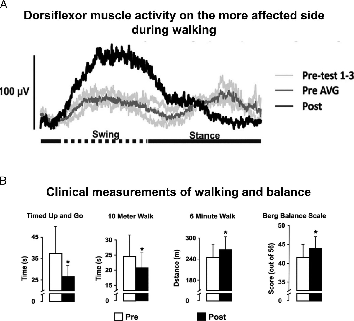 ESSRonline's tweet photo. New ESSR article examines the impact of human ancestry on post-stroke neuroplasticity. #OpenArticle + Journal Club questions! Article by Sun and @E_PaulZehr https://t.co/vMkeyeMV1P https://t.co/MRuO21c7we