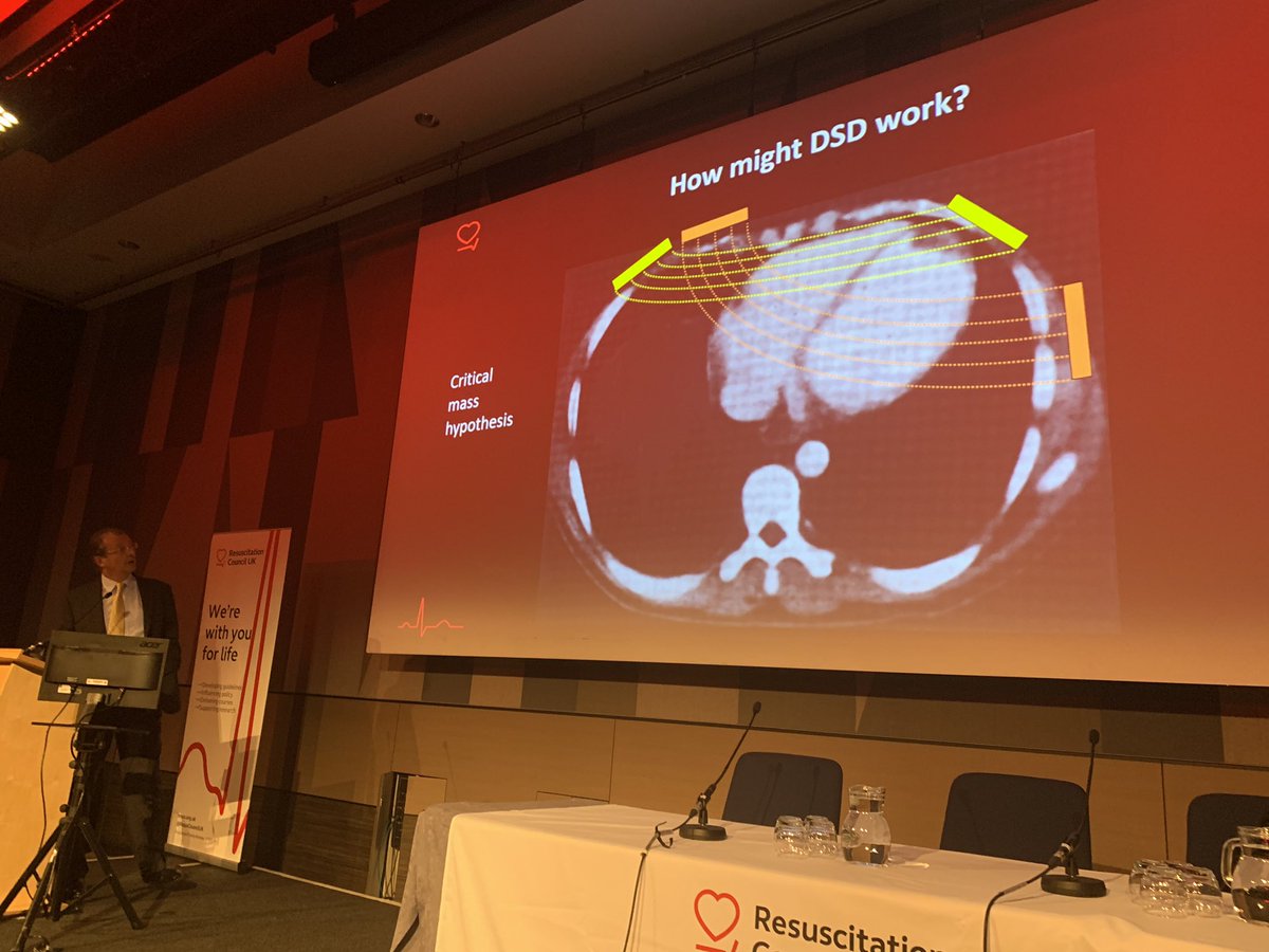 DaveLBywater's tweet image. The correct positioning of defibrillator pads is vitally important, only around 4% of the electricity reaches the myocardium..... Prof Charles Deakin #RCUKAC19