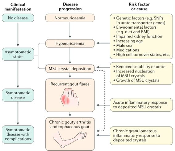 disease progression in gout, showing the corresponding clinical manifestations and risk factors or causes