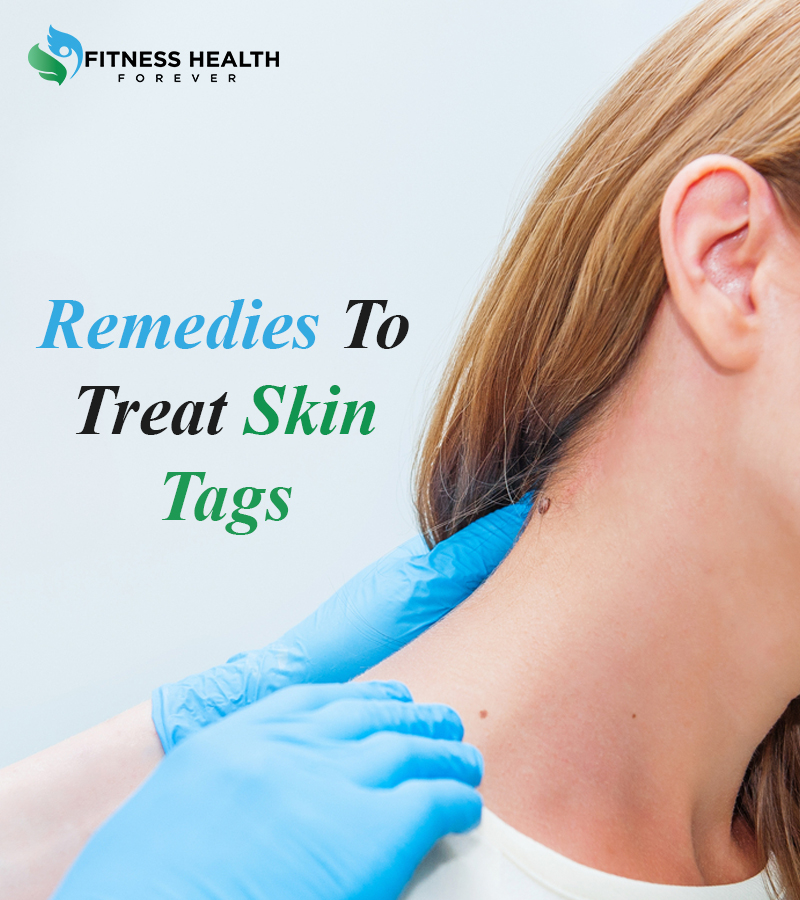 FitnessHealthF1's tweet photo. Let’s kick things off with an amazing fact-almost every human being on this earth shall develop a skin tag once in his or her life.
https://t.co/8urLEB1p8p
#Health_forever #meditation #Yoga #fitness_health_forever
#fitness #wellness_forever
#skin_tags #natural_remidy https://t.co/sHHRMnSaD4