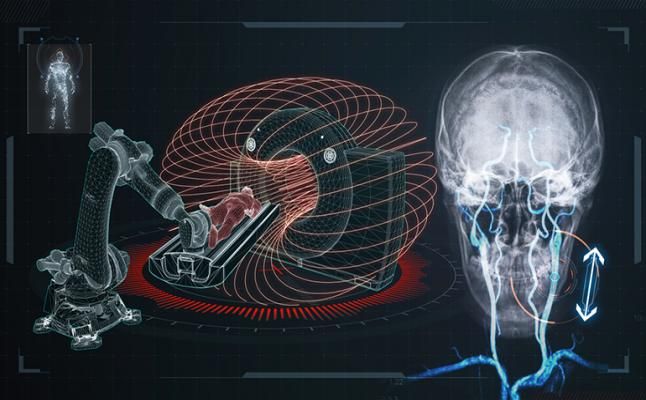 Cn1699's tweet image. Successful Instrument Guidance Through Deep and Convulted Blood Vessel Networks

#endovascularinstruments #Endovascularsurgery #roboticplatform #cn1699news 

For more information, click link below. 👇 
buff.ly/36fKLtv