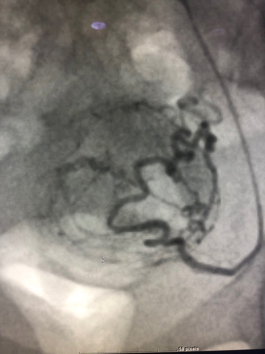 Robert A Lookstein MD, MHCDL tweet media