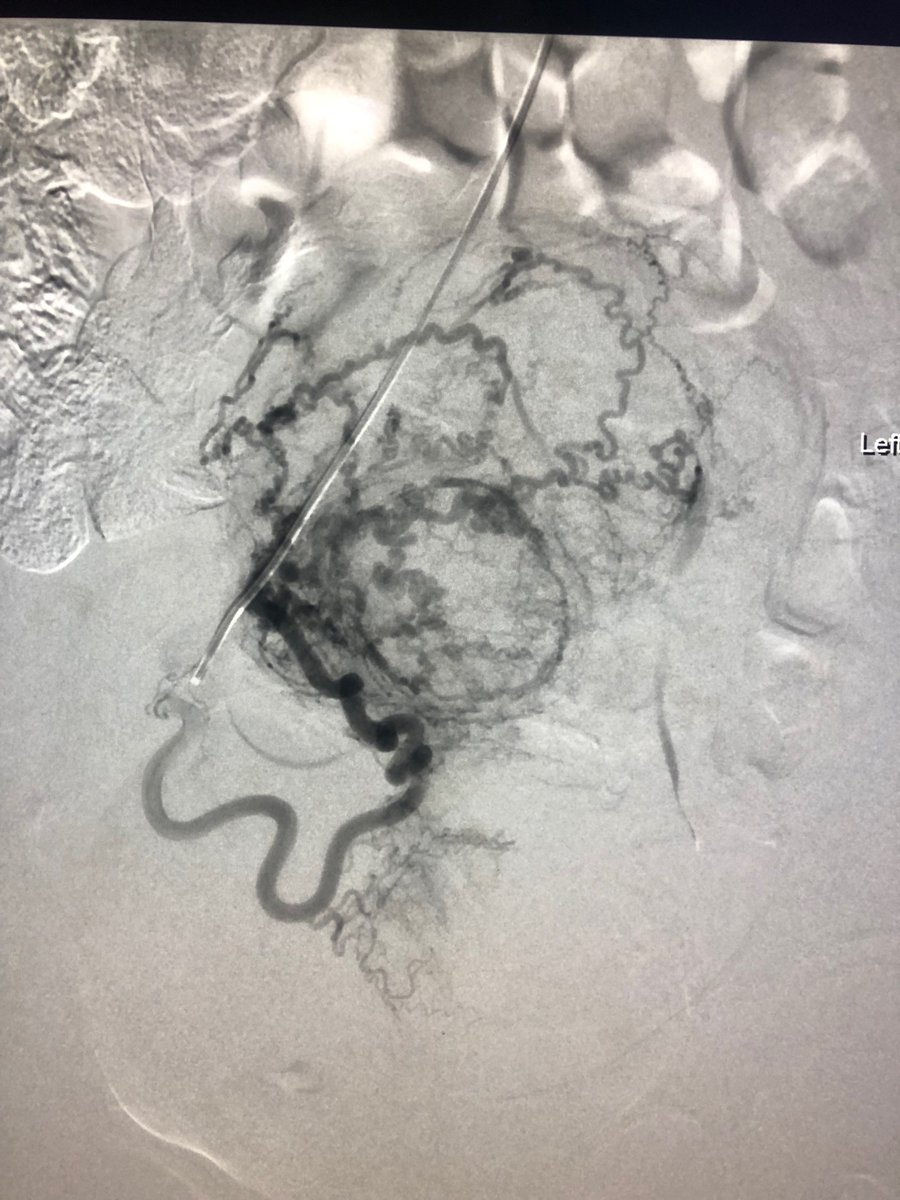 Robert A Lookstein MD, MHCDL tweet media