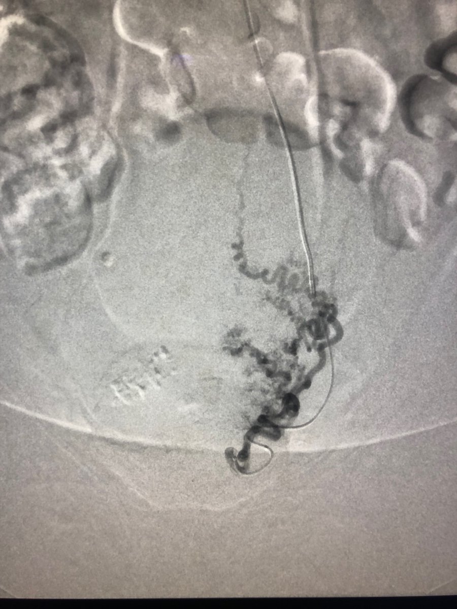 Robert A Lookstein MD, MHCDL tweet media