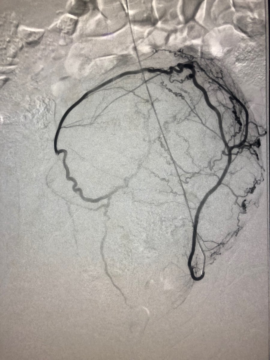 Robert A Lookstein MD, MHCDL tweet media