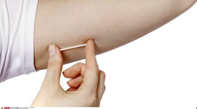 gynmarseille's tweet photo. l’ANSM invite toutes les femmes porteuses d’un implant contraceptif Nexplanon à s’assurer par une palpation délicate qu’il est bien en place. Dans le cas contraire une consultation médicale doit être programmée.
https://t.co/u3pQqMxB0m https://t.co/OPadrhEgXu