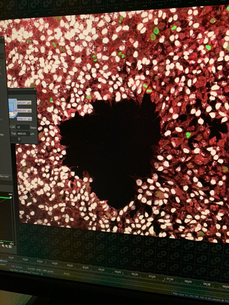 Sarah_Bethy_'s tweet photo. My cells gave me a heart 💖 https://t.co/8EOilxwgrv