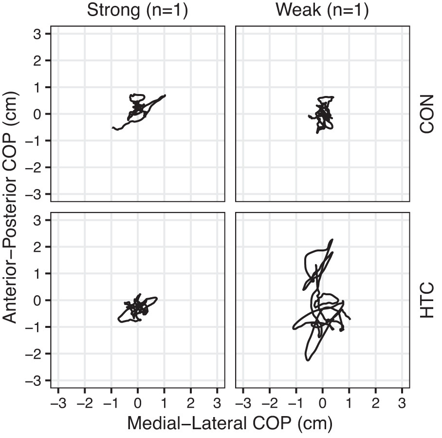 ajpheartcirc's tweet photo. FREE Article of the Week - By introducing challenges that increased the drop in #brain #BloodFlow in healthy young adults, researchers show *for the first time* a direct link to greater postural instability https://t.co/F8uHfeFG1T #FallRiskAssessment @SchlegelUW_RIA https://t.co/oVZb7CO9pL