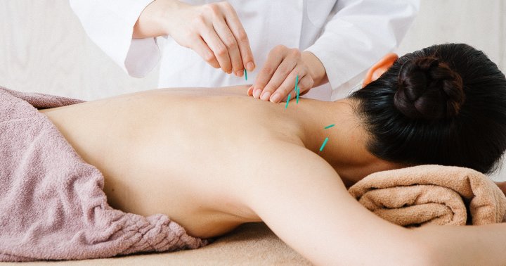 BrainFitNow's tweet image. 5 Benefits Of Acupuncture For Brain Health (Plus, What Each Type Does). ow.ly/wY4d50xd5m9 via @mindbodygreen #Alzheimers #dementia #dementiarisk #brainhealth