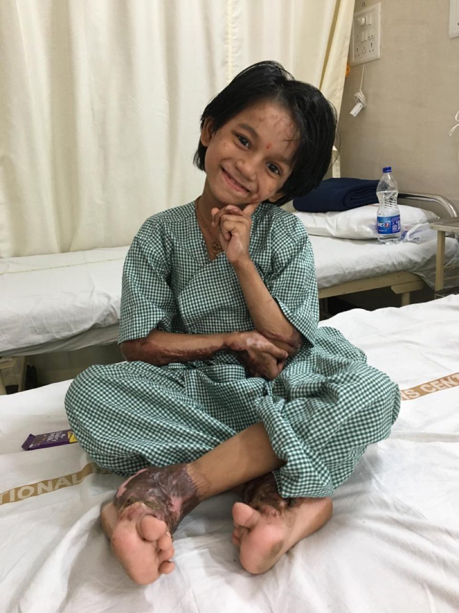 T2/2  OPERATION RESTORE Camp 22 at #NBC - PROJECT OF ROTARY Dist 3141 under DG Harjit Talwar
*Lead Clubs*
RCs Deonar &amp; Bombay North
Supported by
10 Plastic Surgeons
8 Anesthesiologists
Volunteers from SWITCH INDIA
Nurses from Sandra Roffel College of Nursing
National Burns Center