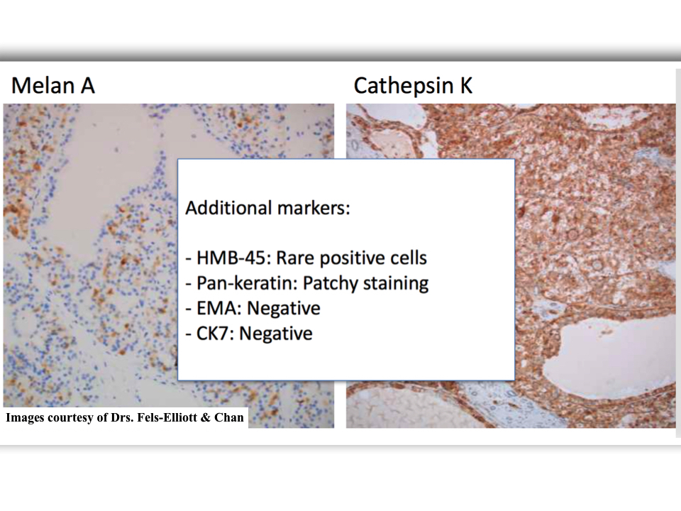 South Bay Pathology tweet media
