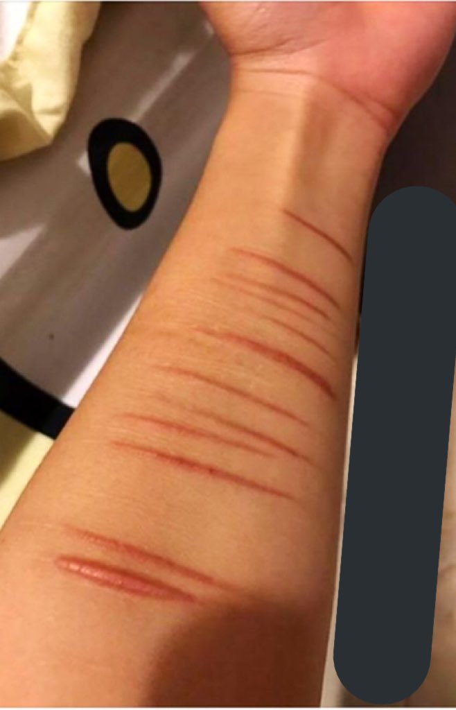 _xYudaix_'s tweet photo. กลับมาจนได้รอยแบบนี้ 🙃 https://t.co/7yqc3EcyVE