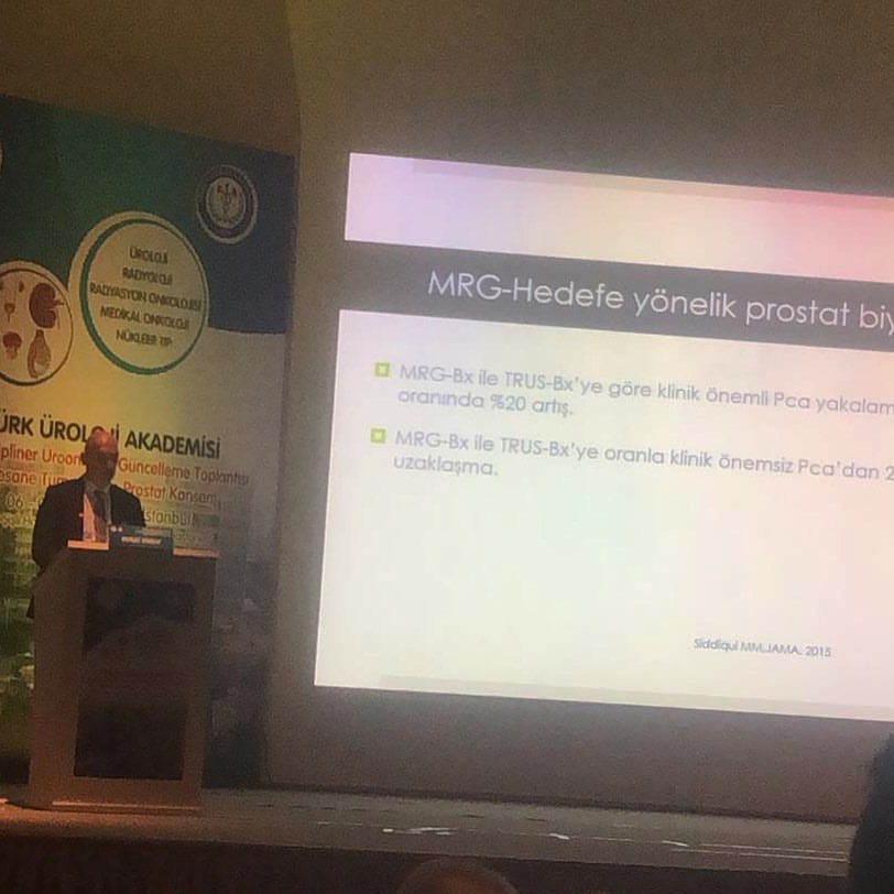 DrMuratBinbay's tweet photo. Prostat Kanseri tanısında hangi tip prostat biyopsisi yapmak lazım? Türk Üroloji Derneğinin multidisipliner toplantısında prostat biyopsi deneyimlerimizi anlattım. 
#prostat #prostatkanseri #prostatkanseribelirtileri #prostatkanseritedavisi #prostatbiyopsisi #prostatbi̇yopsi̇ https://t.co/hi7xZRojsr