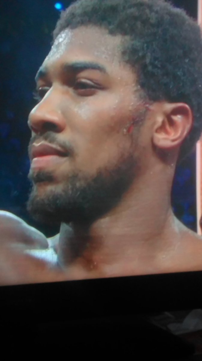 GET INNNNN!!!!!!!!

#WorldChamp
#JoshuaRuiz2 #JoshuavsRuiz #JoshuaRuizJr2  <a href="/RealCFrampton/">Carl Frampton MBE</a> 
#NIHotelAwards