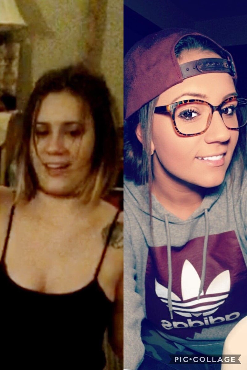 ProjectWhitney's tweet photo. Congrats to Emily in three years on March 17th! You are amazing girl! Please retweet her recovery from addiction! #addiction #recoverygoals #recovery #drugs #activeaddiction #beforeandafter #love #bctwp #retweet #goals #journey #life #proudmoments https://t.co/GsgJ1X42GX