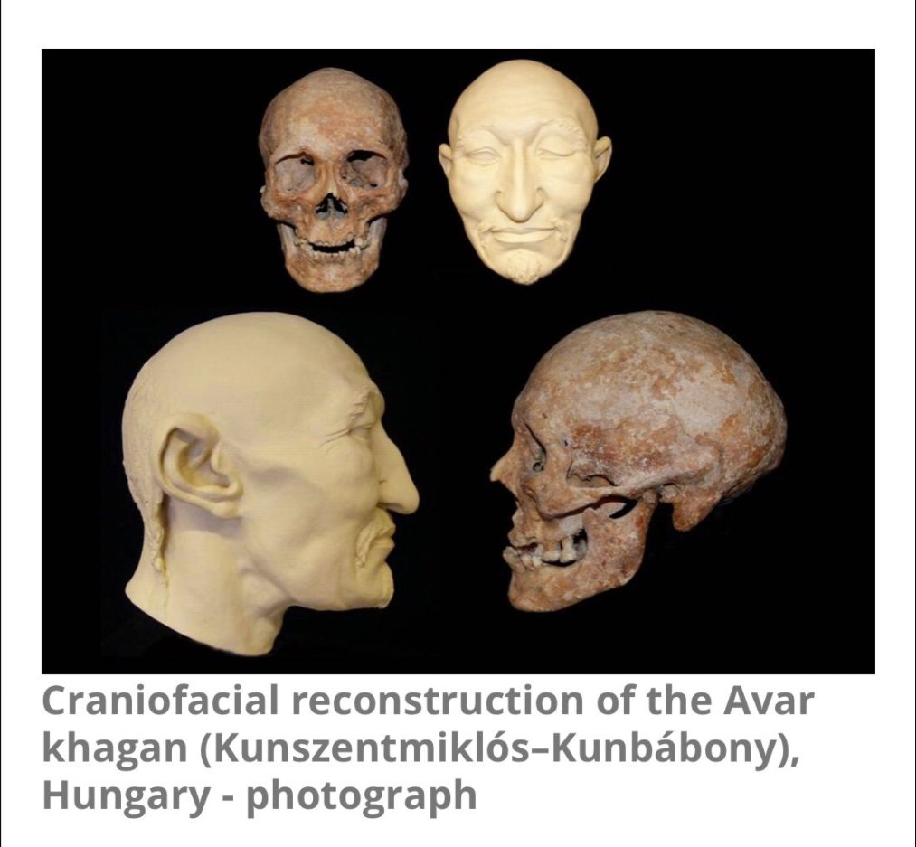 Through comparisons of skull structure, Hakan was able to discover possible back-migrations of Amerindians to Eurasia. Genetic evidence is currently inconclusive.